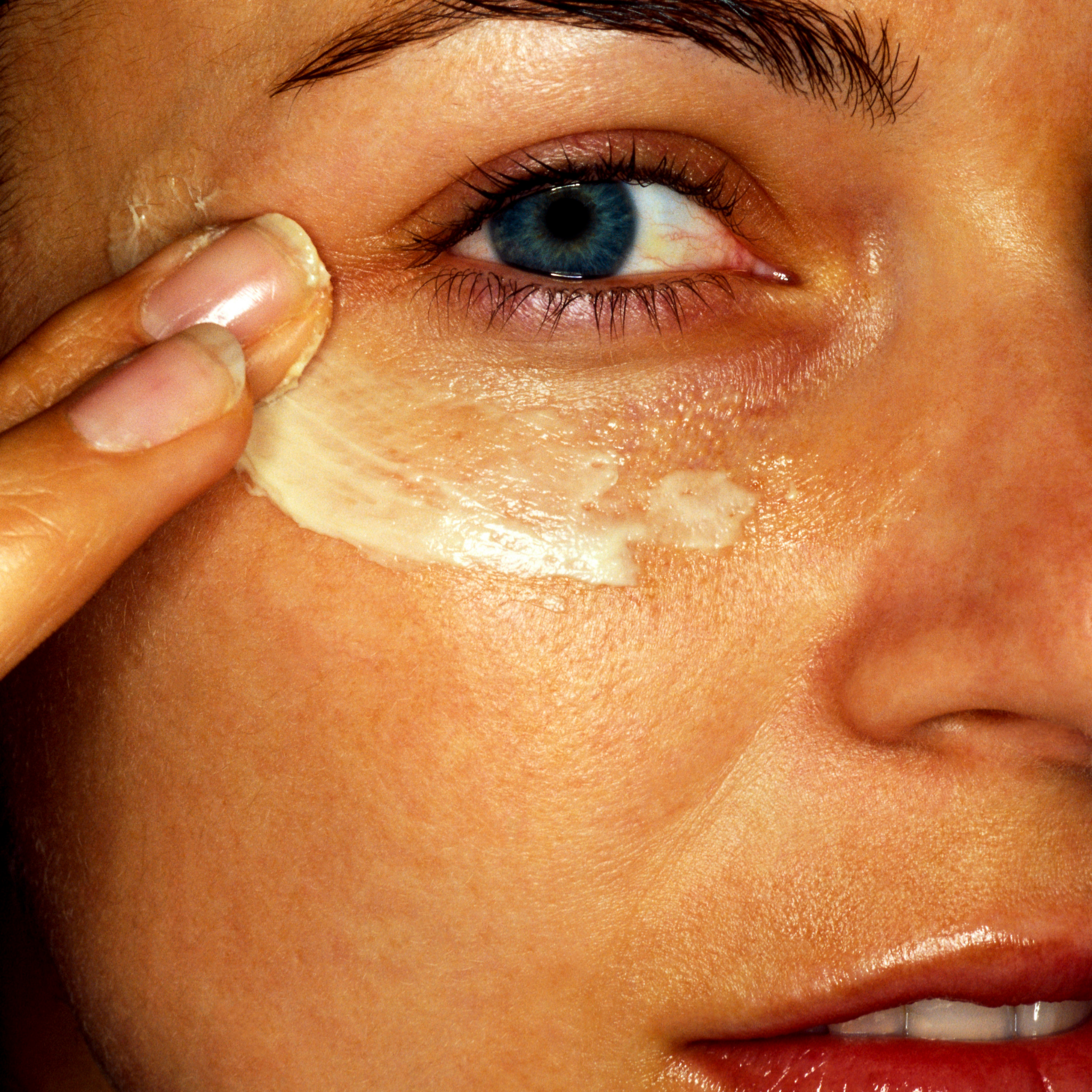 NeutralEyes Eye Complex RAOOF MD Dermatology White Cream under woman eye